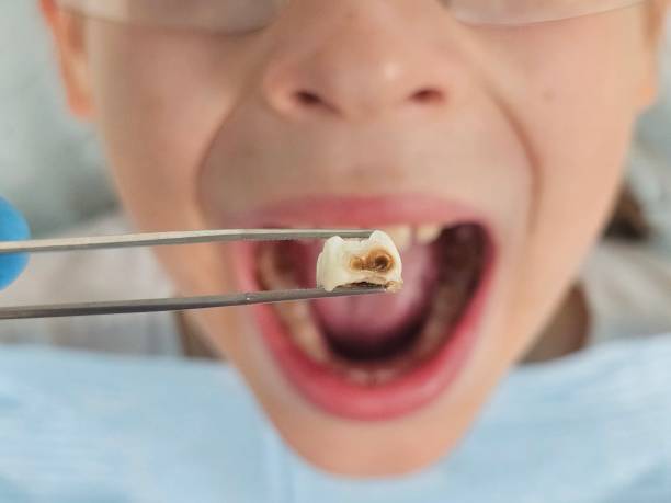 Best Weekend Emergency Dental Services in Council Grove, KS
