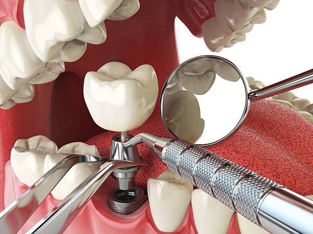 Best Emergency Care for Gum Disease in Council Grove, KS